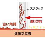 スクラッチの人気の秘密